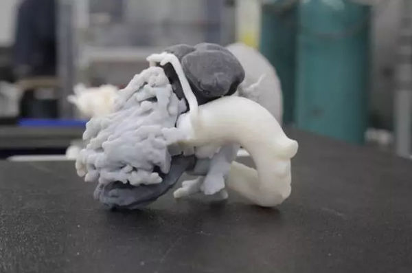 3D打印医疗模型可让患者清楚身体的问题